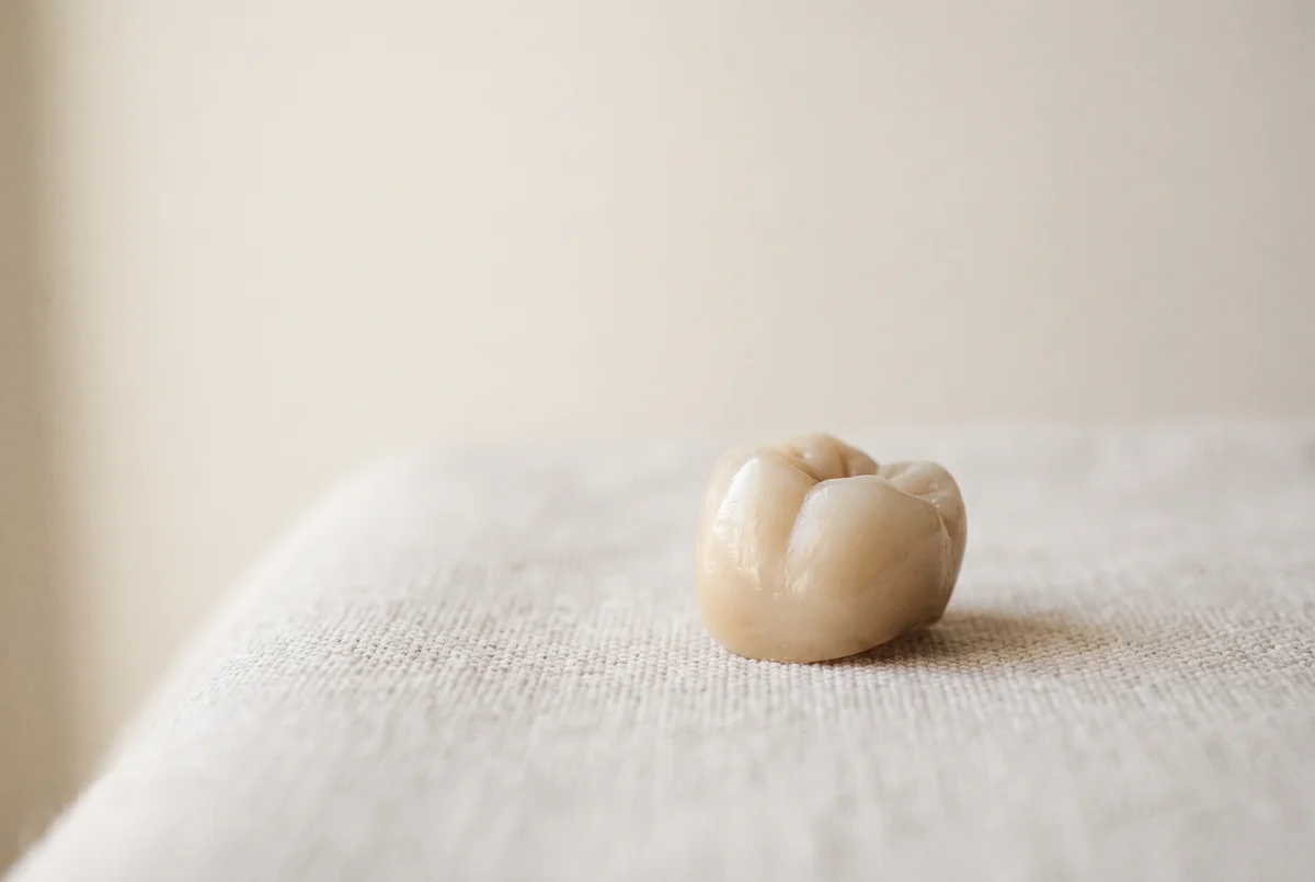 A Pistoia, la capsula del dente devitalizzato è caduta — Studi Dentistici Adamanti Pistoia