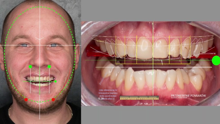 Quanto Conta da 1 a 10 l’Estetica Dei Denti per Una Persona in Carriera